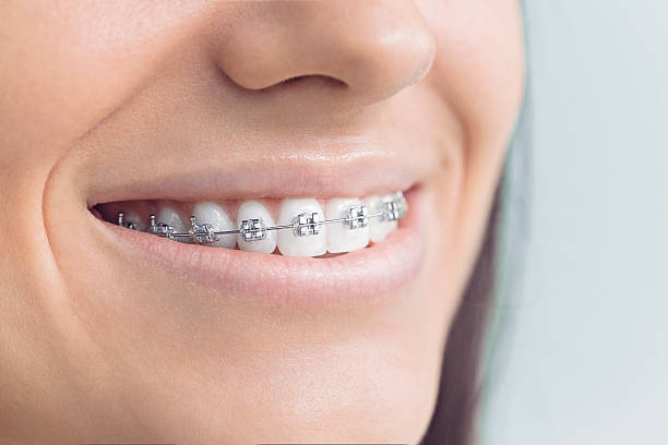 Best Wisdom Tooth Removal  in Glendora, NJ